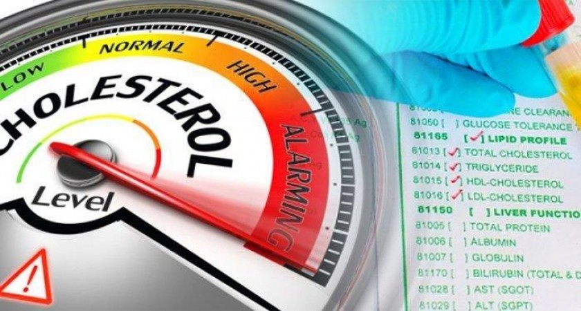 Cek Kolesterol Tetap Penting Selama Pandemi Covid 19
